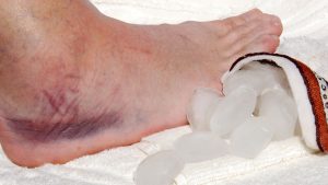 ¿Es conveniente aplicar hielo en las inflamaciones agudas?